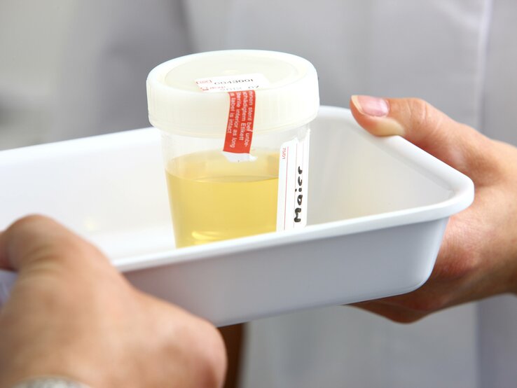 Nach Abgabe einer Urinprobe kann das Labor eine Harnwegsinfektion diagnostizieren. Abgabe einer Urinprobe zur Analyse, im Labor.