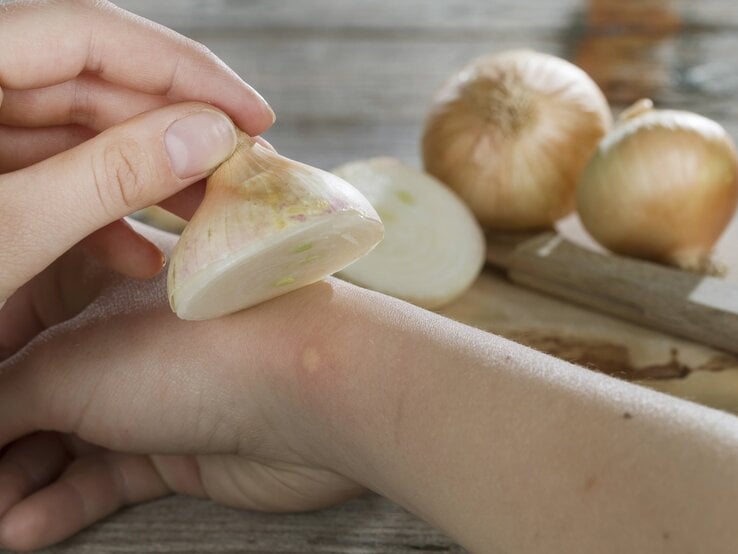 Zwiebelsaft hilft bei Wespen- und Insektenstichen: Er wirkt entzündungshemmend und antiallergen. | © Imago/blickwinkel wespezwiebel.jpg | © Imago/blickwinkel