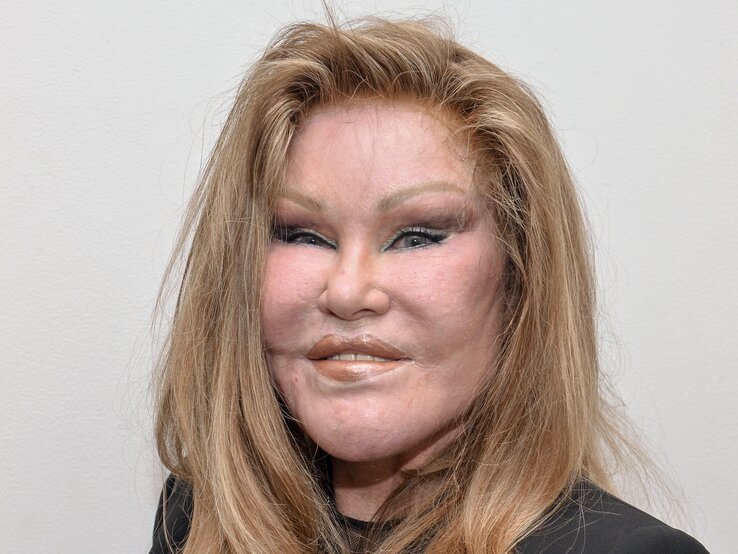 Jocelyn Wildenstein, auch als Katzenfrau bekannt