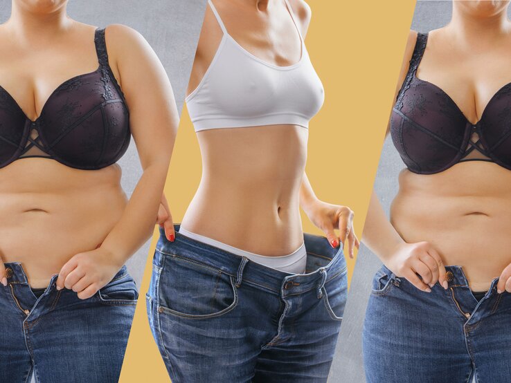 Collage mit drei Ansichten eines weiblichen Oberkörpers in Jeans: links und rechts mit sichtbarem Bauchfett, in der Mitte eine schlankere Taille; Darstellung einer Gewichtsabnahme ohne Gesicht.