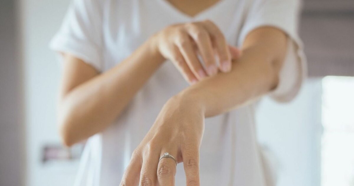 Nesselsucht: Behandlungstipps und Hausmittel gegen Urtikaria