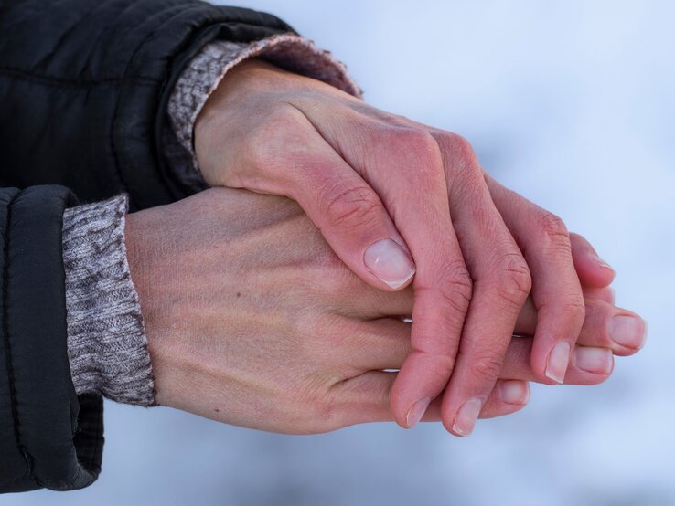 trockene Hände im Winter Hände, die ineinander gelegt sind, vermutlich um sich zu wärmen. Die Haut der Hände wirkt trocken und leicht gerötet, was auf kaltes Wetter oder trockene Winterluft hindeutet.